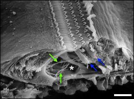 Fracture de l'organe de Corti : microscopie électronique à balayage (MEB)