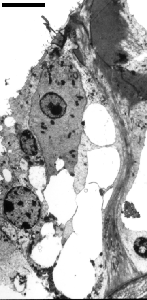 microscopie électronique de cellules ciliées