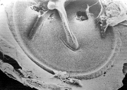 Vue en microscopie électronique à balayage d'un tympan de cobaye.