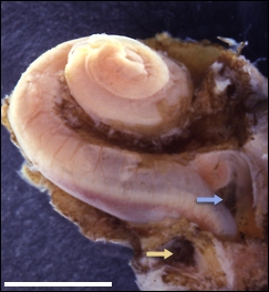 Cochlée humaine (foetus de 5 mois)