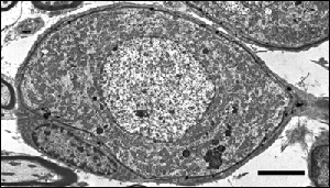 Neurone ganglionnaire de type-I et sa cellule gliale "satellite"