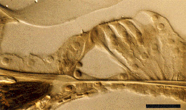 Tour basal (bas) et apical (haut) d'une cochlée de cobaye