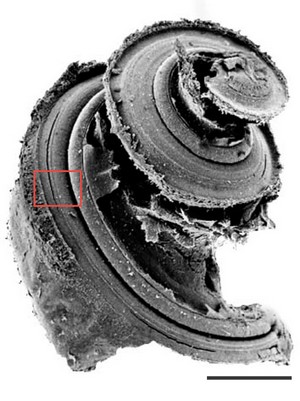 Spirale cochléaire: microscopie électronique à balayage (MEB)